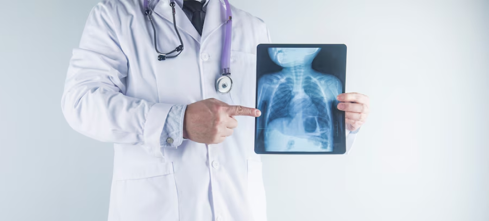 Pulmonary Treatment in SN Hospital